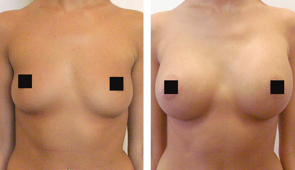 заставка с увеличенной женской грудью